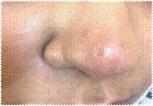 A close up of a person's ear
Description automatically generated with low confidence