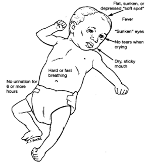 sings of dehydration 